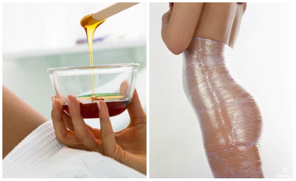 περιτυλίγματα σώματος για απώλεια βάρους